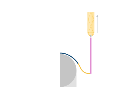 images/download/attachments/142652832/Retract_%28By_Normal_Arc%29.png