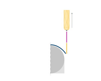 images/download/attachments/142652832/Retract_%28By_Vertical_Normal%29.png