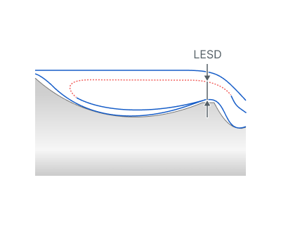 images/download/attachments/142655397/Lead_Safe_Distance.png
