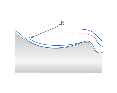 images/download/attachments/142655397/Linkining_radius.png