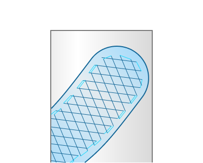 images/download/attachments/142644988/planar_Alternate_lines_direction_%28on%29.png